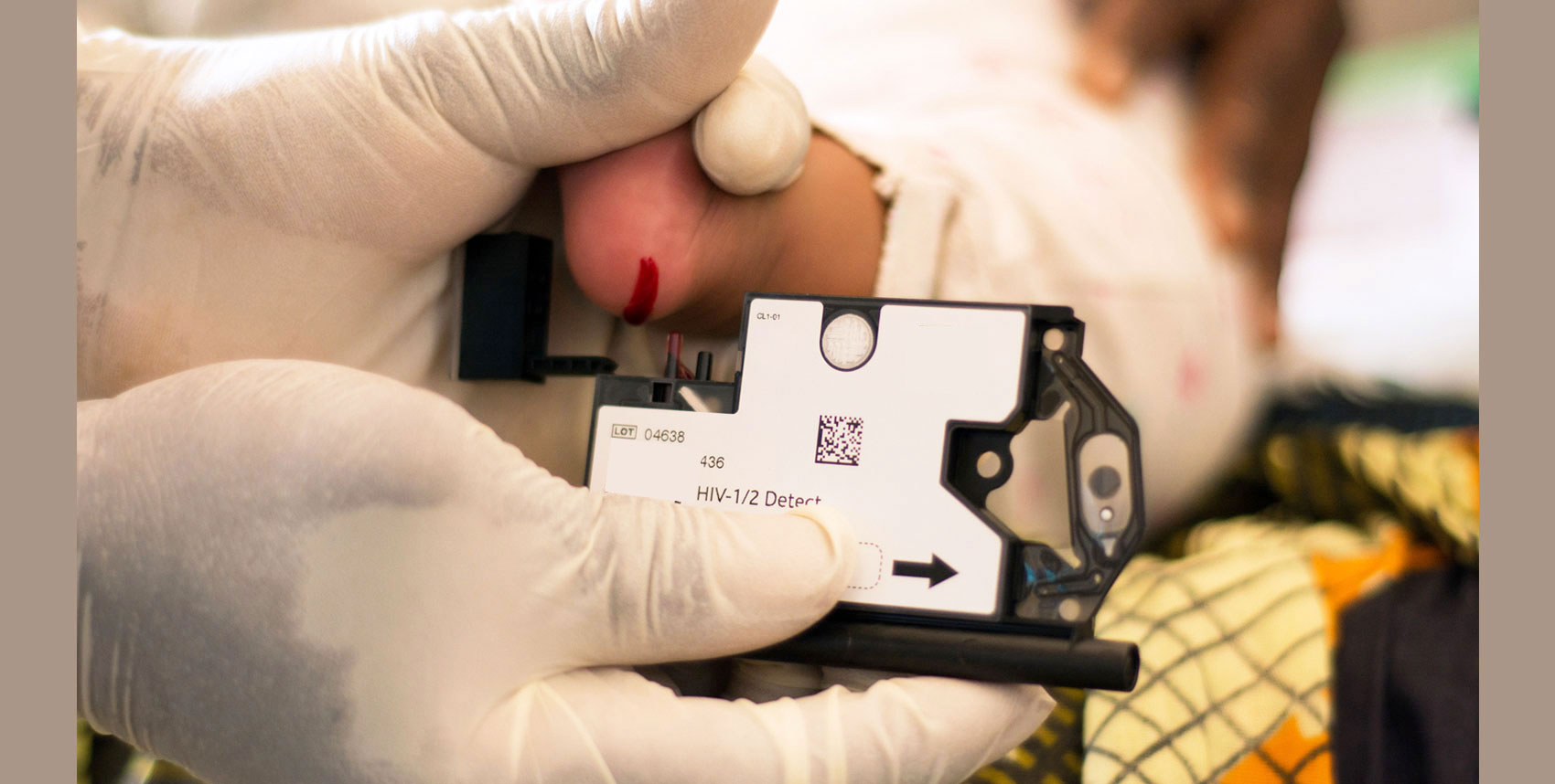 Rapid HIV diagnostic blood test